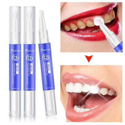 Dazzling White Instant Teeth Whitening Pen